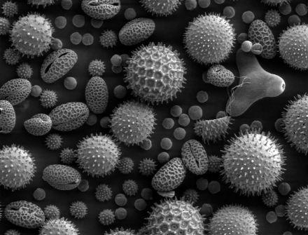 Immagine di alcuni granelli di polline osservati al microscopio elettronico.